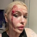 TRAUMA DOLL