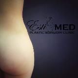 Просто О Пластике (ПоП)