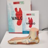 VALGO Здоровье стопы Chat