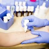 Allergic - Dermatology