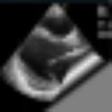 Эхокардиографические вести