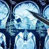 NEUROLOGY CONCILIUM Жетишев