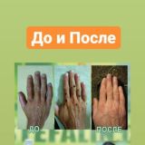 Стефалин обсуждение, отзывы