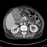 Radiology short cases