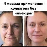 📸 ОТЗЫВЫ❗️20 / КОЛЛАГЕН/ COLLAGEN NL фото/ отзывы 🔴