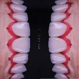 Зубной Техник