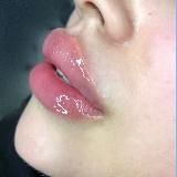 💋💋KOSMETOLOGIYA💋💋