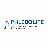 VARIKOZ | PHLEBOLIFE | Toshkent, Samarqand, Nukus, Qo'qon, Navoiy
